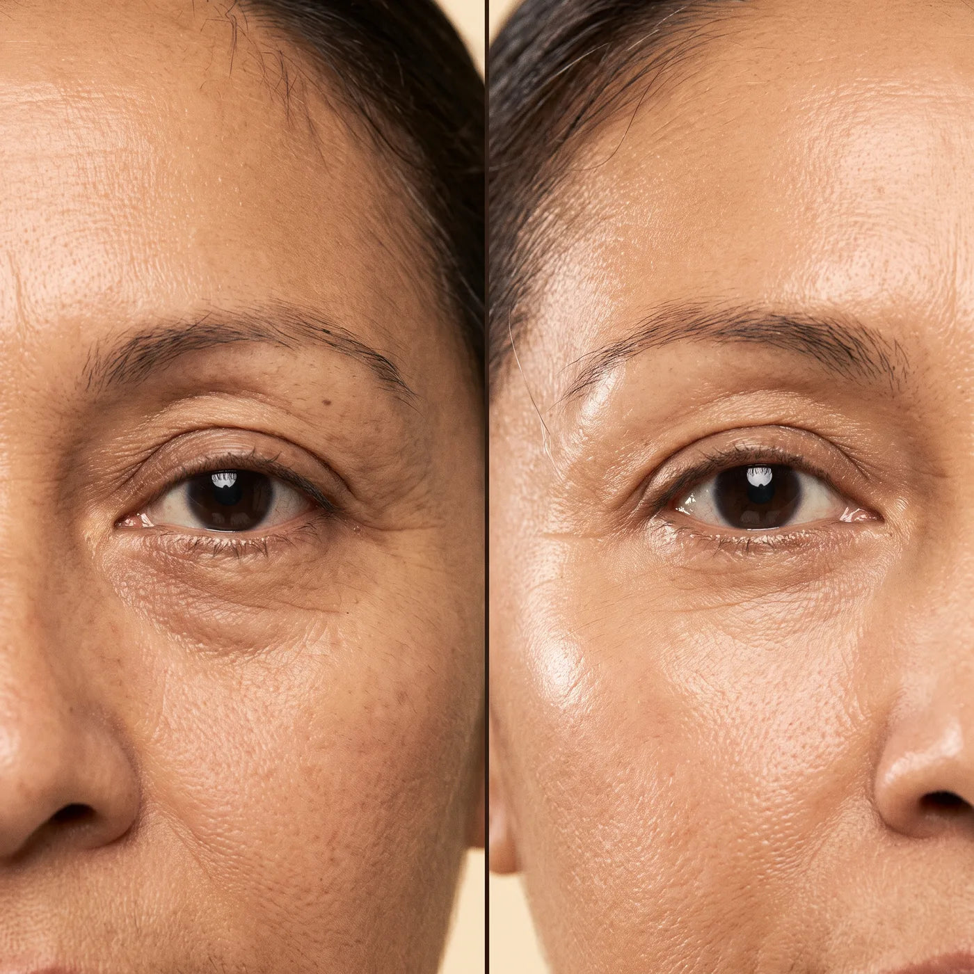 Contorno de ojos antes y después de un mes de uso